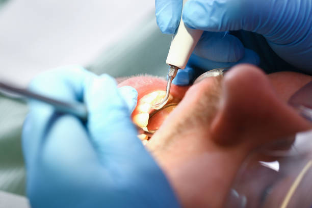 Best Urgent Dental Care for Toothache in St George, SC