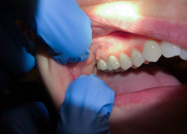 Best Orthodontic Emergency Dentist in St George, SC