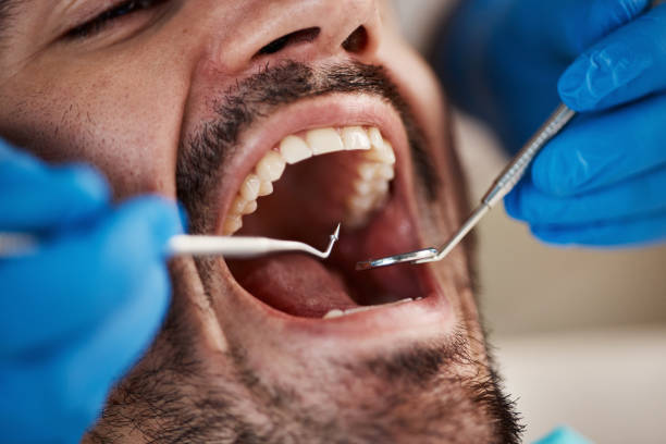 Best Mobile Emergency Dentist in St George, SC
