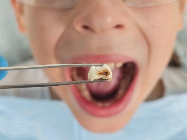 Best Emergency Dentist for Special Needs Patients in St George, SC